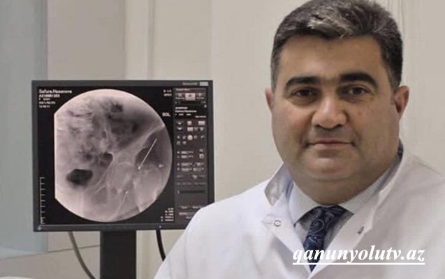 Aydın Əliyev işdən çıxarıldı